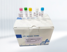 檢測試劑盒 聚合酶鏈?zhǔn)椒磻?yīng)